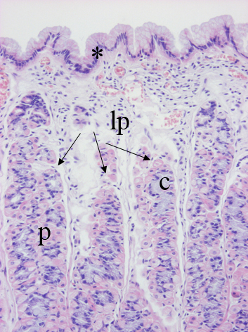 histología del fondo del estómago