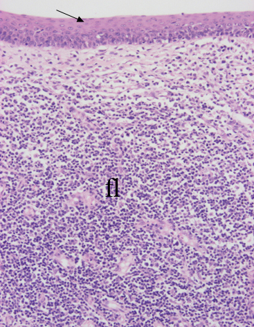 histología de las amígdalas faríngeas